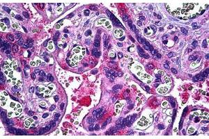 Human Placenta: Formalin-Fixed, Paraffin-Embedded (FFPE)