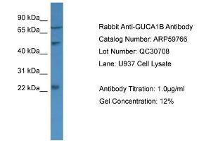 WB Suggested Anti-GUCA1B  Antibody Titration: 0. (GUCA1B anticorps  (N-Term))