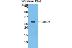 Detection of Recombinant PTCH1, Mouse using Polyclonal Antibody to Patched Homolog 1 (PTCH1) (Patched 1 anticorps  (AA 213-422))