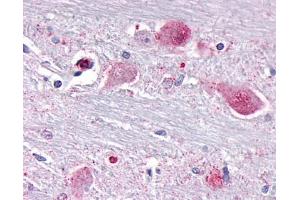Anti-NR1D1 antibody IHC of human brain, neurons and glia. (NR1D1 anticorps  (Internal Region))
