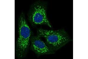 Image no. 1 for anti-Twinfilin, Actin-Binding Protein 1 (TWF1) antibody (ABIN1491429)