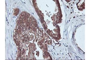 Image no. 5 for anti-Proteasome Subunit alpha 4 (PSMA4) antibody (ABIN1500458)