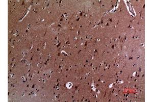 Immunohistochemistry (IHC) analysis of paraffin-embedded Human Brain, antibody was diluted at 1:100. (IL12A anticorps  (Internal Region))
