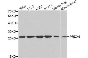 Western blot analysis of extracts of various cell lines, using PRDX6 antibody. (Peroxiredoxin 6 anticorps)