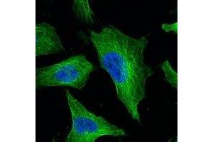 Immunofluorescent analysis of Beta-tubulin staining in Hela cells. (TUBB anticorps)