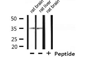 Western blot analysis of extracts from rat liver, rat brain, using CKI-α Antibody.