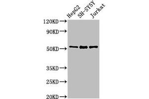 Western Blot Positive WB detected in: HepG2 whole cell lysate, SH-SY5Y whole cell lysate, Jurkat whole cell lysate All lanes: PRKN antibody at 3 μg/mL Secondary Goat polyclonal to rabbit IgG at 1/50000 dilution Predicted band size: 52, 49, 24, 31, 43, 36, 44, 47 kDa Observed band size: 52 kDa