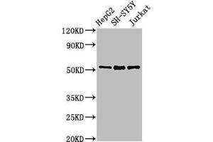 Western Blot Positive WB detected in: HepG2 whole cell lysate, SH-SY5Y whole cell lysate, Jurkat whole cell lysate All lanes: PRKN antibody at 3 μg/mL Secondary Goat polyclonal to rabbit IgG at 1/50000 dilution Predicted band size: 52, 49, 24, 31, 43, 36, 44, 47 kDa Observed band size: 52 kDa (Parkin anticorps  (AA 1-465))