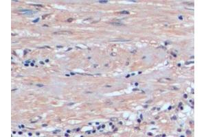 Detection of GSTp in Human Prostate Tissue using Polyclonal Antibody to Glutathione S Transferase Pi (GSTp)