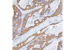 IHC analysis of STON1 using anti-STON1 antibody (ABIN7599896). (STON1 anticorps  (AA 127-688))
