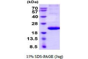 Interleukin 29 (IL29) (AA 20-200) (Active) protein (His tag)