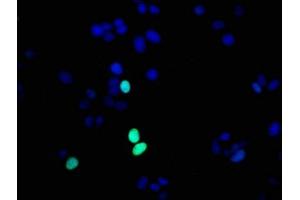 Immunofluorescence staining of MCF-7 cells with ABIN7127308 at 1:56,counter-stained with DAPI. (Recombinant HIST1H1E anticorps  (pThr17))