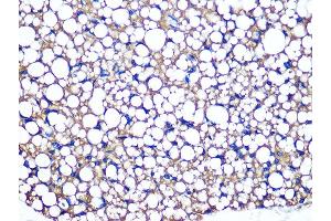Immunohistochemistry of paraffin-embedded mouse brown adipose using Perilipin A Rabbit mAb (ABIN7269218) at dilution of 1:100 (40x lens). (PLIN1 anticorps)
