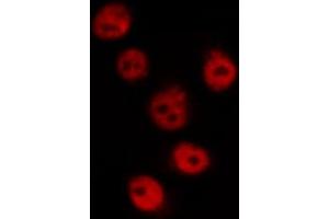 ABIN6269162 staining HeLa by IF/ICC. (CREB1 anticorps  (Internal Region))
