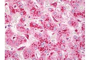 Anti-CYSLT2 / CYSLTR2 antibody IHC of human liver, Kupffer cells.