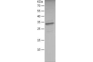 Western Blotting (WB) image for SMAD, Mothers Against DPP Homolog 1 (SMAD1) (AA 1-250) protein (His tag) (ABIN7125121)