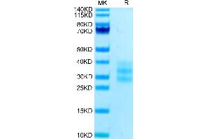 Human FLT3 Ligand on Tris-Bis PAGE under reduced condition. (FLT3LG Protein (AA 27-185) (His tag))