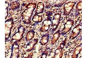 Immunohistochemistry of paraffin-embedded human small intestine tissue using ABIN7158996 at dilution of 1:100 (MARK3 anticorps  (AA 368-667))