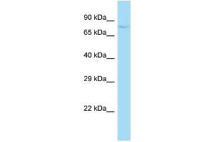 WB Suggested Anti-Sugp1 Antibody   Titration: 1. (Splicing Factor 4 anticorps  (N-Term))