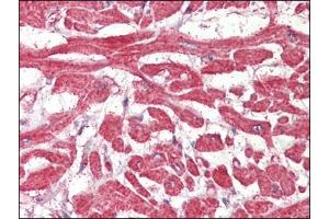 Heart, Human: Formalin-Fixed, Paraffin-Embedded (FFPE) (FABP7 anticorps  (C-Term))
