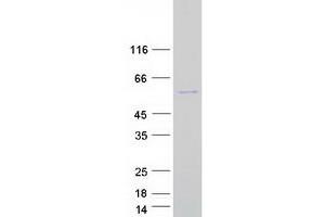 Validation with Western Blot
