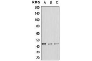 Western blot analysis of ERK1 expression in A431 (A), NIH3T3 (B), PC12 (C) whole cell lysates. (ERK1 anticorps  (Center))