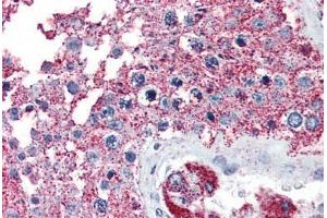 Anti-NEK6 antibody  ABIN1049089 IHC staining of human testis.