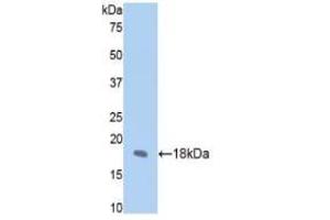 WB of Protein Standard: different control antibodies against Highly purified E.