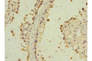Immunohistochemistry of paraffin-embedded human testis tissue using ABIN7143441 at dilution of 1:100 (BST1 anticorps  (AA 29-293))