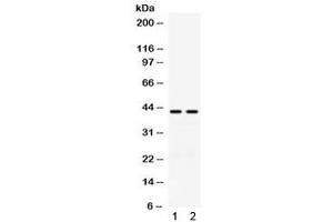 Western blot testing of human 1) A549 and 2) COLO320 cell lysate with RAD51C antibody. (RAD51C anticorps)