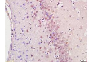 Formalin-fixed and paraffin embedded rat brain labeled with Anti-RASSF8 Polyclonal Antibody, Unconjugated (ABIN762266) at 1:200 followed by conjugation to the secondary antibody and DAB staining