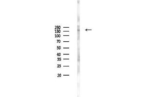 anti-GTPase Activating Protein and VPS9 Domains 1 (GAPVD1) antibody