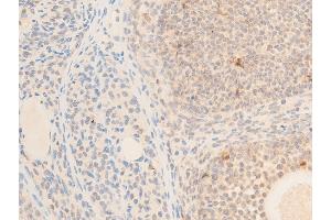 ABIN6267236 at 1/100 staining rat ovarian tissue sections by IHC-P.
