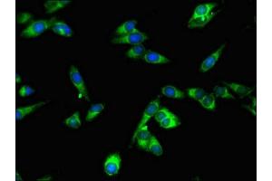 Immunofluorescent analysis of Hela cells using ABIN7169623 at dilution of 1:100 and Alexa Fluor 488-congugated AffiniPure Goat Anti-Rabbit IgG(H+L) (SPPL2A anticorps  (AA 26-172))