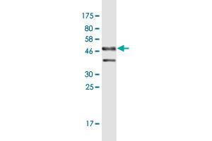 Western Blot detection against Immunogen (46. (DMRTB1 anticorps  (AA 1-189))