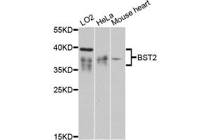 Western blot analysis of extracts of various cell lines, using BST2 antibody (ABIN6129547, ABIN6137673, ABIN6137675 and ABIN6215924) at 1:3000 dilution. (BST2 anticorps  (AA 49-161))