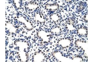 POP4 antibody was used for immunohistochemistry at a concentration of 4-8 ug/ml to stain Alveolar cells (arrows) in Human Lung. (RPP29 anticorps)