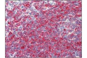 Immunohistochemistry (IHC) image for anti-Programmed Cell Death 4 (PDCD4) (AA 1-469), (N-Term) antibody (ABIN317548) (PDCD4 anticorps  (N-Term))