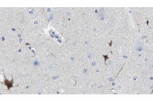 ABIN6274610 at 1/100 staining Human brain cancer tissue by IHC-P. (Cell Adhesion Molecule 4 anticorps  (C-Term))
