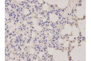 Immunohistochemistry (IHC) image for anti-Lipopolysaccharide-Induced Tumor Necrosis Factor-alpha Factor (LITAF) antibody (ABIN1876657) (LITAF anticorps)