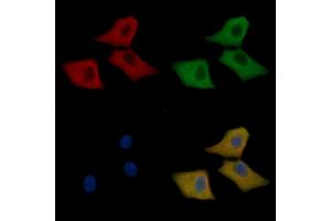 Peroxiredoxin 1 Mouse Monoclonal Antibody staining Hela cells by IF/ICC. (Peroxiredoxin 1 anticorps  (C-Term))