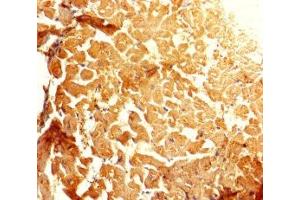 Immunohistochemistry of paraffin-embedded human heart tissue using ABIN7143697 at dilution of 1:100 (GALM anticorps  (AA 2-342))