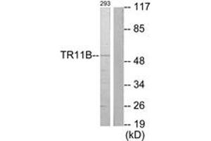 Western blot analysis of extracts from 293 cells, using TR11B Antibody . (Osteoprotegerin anticorps  (AA 10-59))