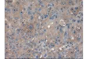 Immunohistochemical staining of paraffin-embedded kidney using anti-PTCH1 (ABIN2452537) mouse monoclonal antibody. (Patched 1 anticorps  (AA 122-436))