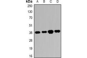 Western blot analysis of RRP7A/B expression in K562 (A), HEK293T (B), SHSY5Y (C), mouse eye (D) whole cell lysates. (RRP7A/B (C-Term) anticorps)