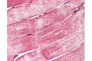 Anti-DNAJA3 / TID1 antibody IHC of human skeletal muscle. (DNAJA3 anticorps  (C-Term))