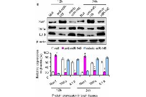 The axis signaling of miR-145-5p-Nurr1-TNF-α in acute MCAO/R model of rats by in vivo expriments. (beta Actin anticorps)