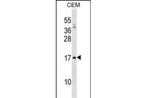 VPREB1 Antibody (Center) (ABIN1538592 and ABIN2838302) western blot analysis in CEM cell line lysates (35 μg/lane). (VPREB1 anticorps  (AA 71-99))