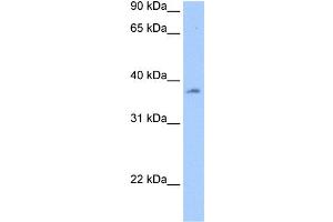 WB Suggested Anti-RBMY1A1 Antibody Titration:  0.