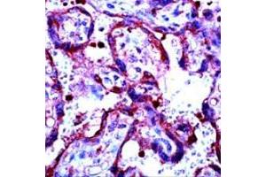 Immunohistochemical staining of human placenta stained with MMP9 polyclonal antibody  at 1 : 100 for 10 min at RT.